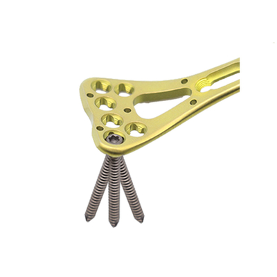 Medical Orthopedic Multi-Axial Distal Radius Medial Locking Plate