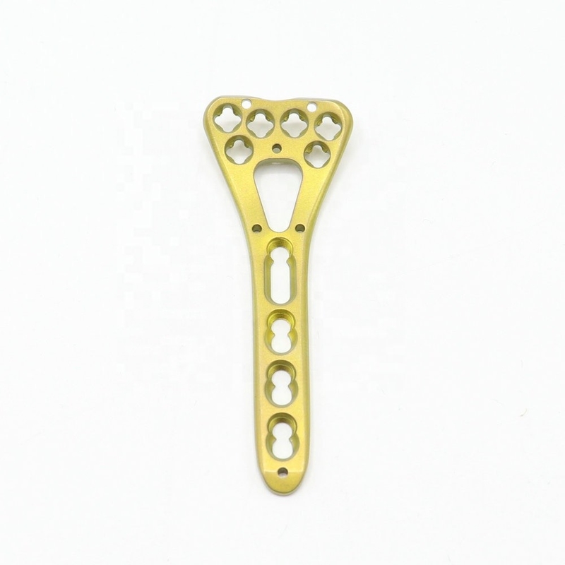 Medical Orthopedic Multi-Axial Distal Radius Medial Locking Plate