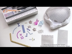 턱과 얼굴에 관한 시스템 비디오